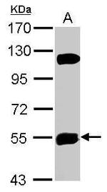 KATNAL1 Antibody in Western Blot (WB)