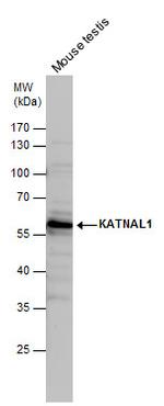 KATNAL1 Antibody in Western Blot (WB)