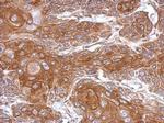 THOC5 Antibody in Immunohistochemistry (Paraffin) (IHC (P))