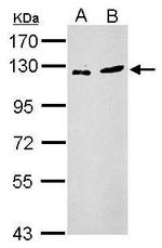 ZNF711 Antibody in Western Blot (WB)