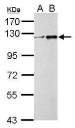 ZNF711 Antibody in Western Blot (WB)