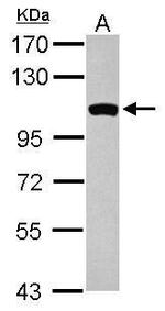 GCC1 Antibody in Western Blot (WB)