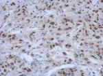 CIRBP Antibody in Immunohistochemistry (Paraffin) (IHC (P))