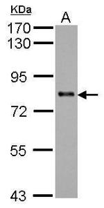 KCTD3 Antibody in Western Blot (WB)