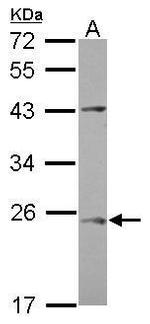 C1orf146 Antibody in Western Blot (WB)