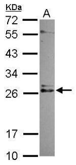 IMP3 Antibody in Western Blot (WB)