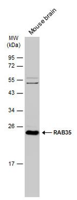 RAB35 Antibody in Western Blot (WB)