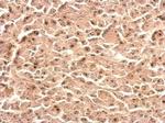 Nop25 Antibody in Immunohistochemistry (Paraffin) (IHC (P))