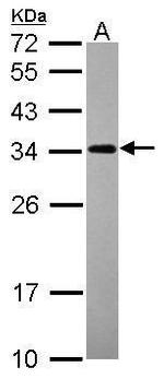 Nop25 Antibody in Western Blot (WB)