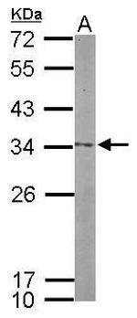 Nop25 Antibody in Western Blot (WB)