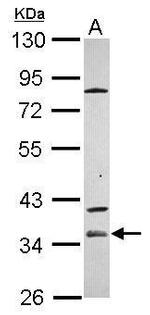 ZP1 Antibody in Western Blot (WB)