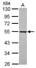 PARS2 Antibody in Western Blot (WB)