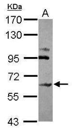 CHST15 Antibody in Western Blot (WB)
