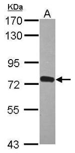 ZNF417 Antibody in Western Blot (WB)