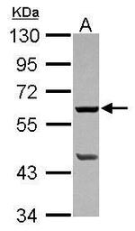 PLA2G4F Antibody in Western Blot (WB)