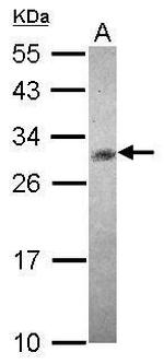 CHAC1 Antibody in Western Blot (WB)