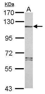 NALP7 Antibody in Western Blot (WB)