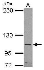 SLITRK5 Antibody in Western Blot (WB)