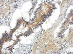 TBC1D15 Antibody in Immunohistochemistry (Paraffin) (IHC (P))