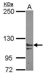 XPO6 Antibody in Western Blot (WB)