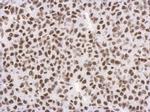 H3K27me3 Antibody in Immunohistochemistry (Paraffin) (IHC (P))