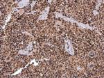 KDM6A Antibody in Immunohistochemistry (Paraffin) (IHC (P))