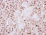 KDM6A Antibody in Immunohistochemistry (Paraffin) (IHC (P))