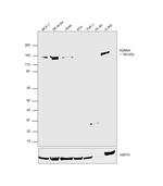 KDM6A Antibody in Western Blot (WB)