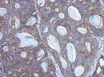 PITRM1 Antibody in Immunohistochemistry (Paraffin) (IHC (P))