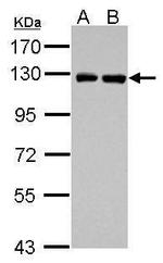 PITRM1 Antibody in Western Blot (WB)