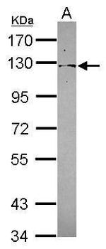 PSD4 Antibody in Western Blot (WB)