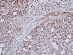 ZNF417 Antibody in Immunohistochemistry (Paraffin) (IHC (P))