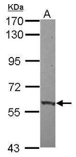 ZNF417 Antibody in Western Blot (WB)