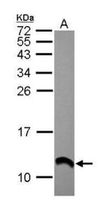 S100A2 Antibody in Western Blot (WB)
