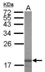 Galectin 7 Antibody in Western Blot (WB)