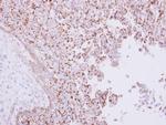 RHAMM Antibody in Immunohistochemistry (Paraffin) (IHC (P))