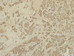 RHAMM Antibody in Immunohistochemistry (Paraffin) (IHC (P))