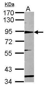 RHAMM Antibody in Western Blot (WB)