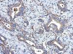 MRPL18 Antibody in Immunohistochemistry (Paraffin) (IHC (P))