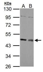 MEK1/MEK2 Antibody in Western Blot (WB)