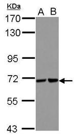 STS1 Antibody in Western Blot (WB)