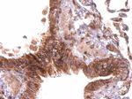 PABPC4 Antibody in Immunohistochemistry (Paraffin) (IHC (P))