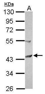 SCCPDH Antibody in Western Blot (WB)