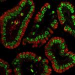 Histone H3 Antibody in Immunohistochemistry (Paraffin) (IHC (P))