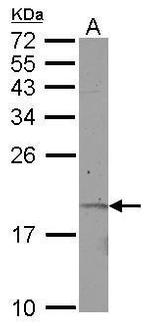 KRTAP11-1 Antibody in Western Blot (WB)