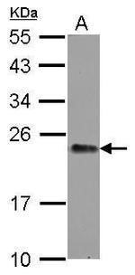 GNPNAT1 Antibody in Western Blot (WB)