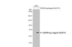 GALNT14 Antibody in Western Blot (WB)