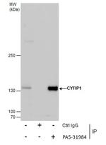 CYFIP1 Antibody in Immunoprecipitation (IP)