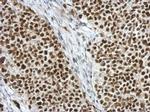 C17orf49 Antibody in Immunohistochemistry (Paraffin) (IHC (P))