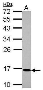 C17orf49 Antibody in Western Blot (WB)